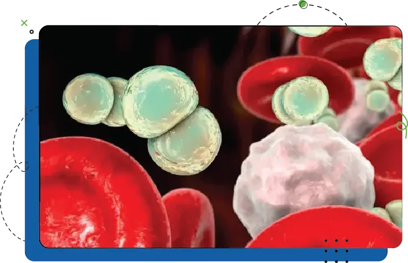 Pathophysiology_LightBG Pathophysiology_LightBG