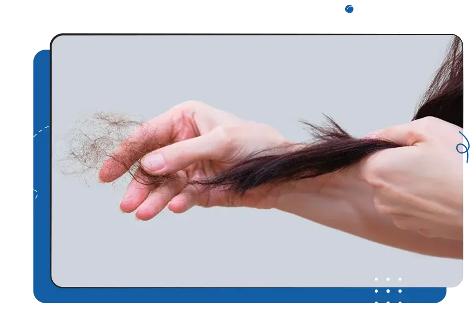 iCEVCourses_HairScalpDisorders